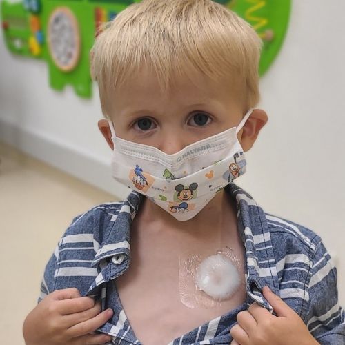 Child showing port while wearing face mask