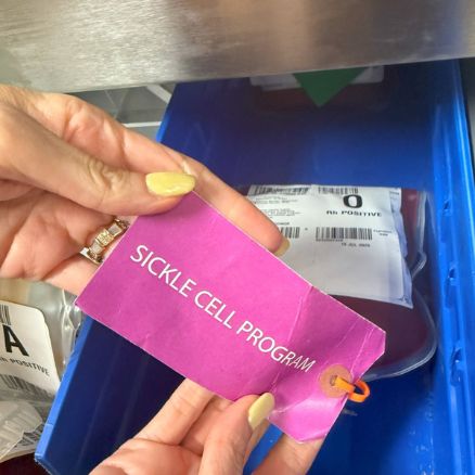 Blood Bag with "Sickle Cell Blood Program" tag